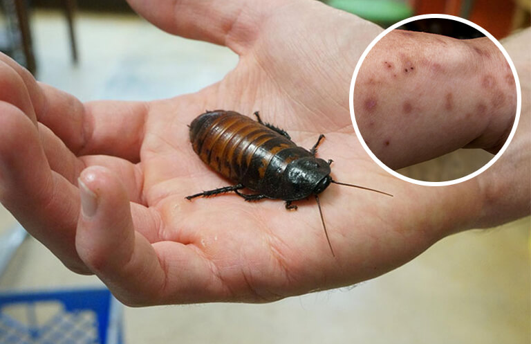  cockroach treatment